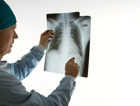 Examen radiologique pendant la grossesse