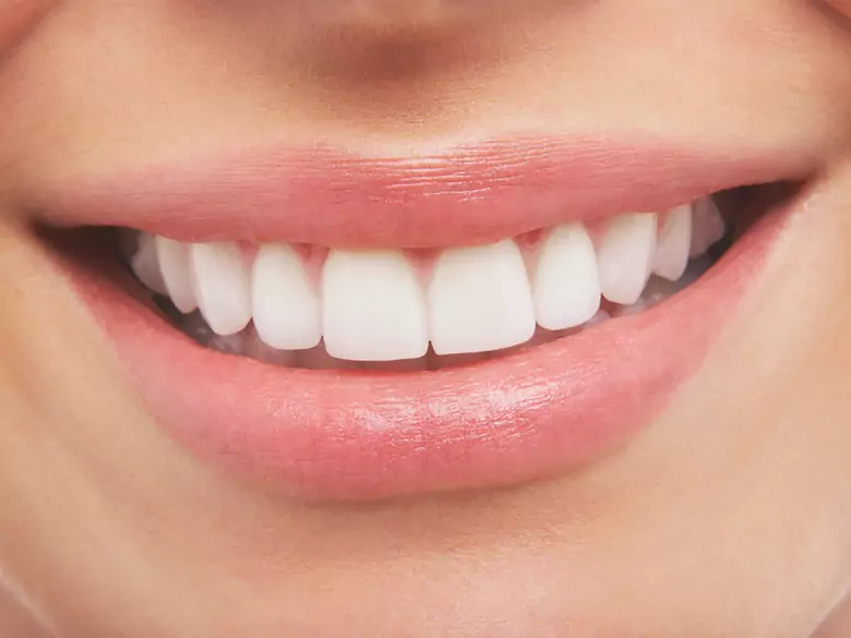 Restaurations sur implants