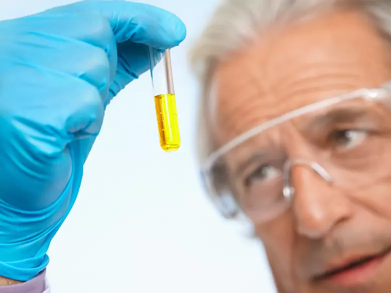 Tumeurs neuroendocrines et collecte quotidienne d'urine