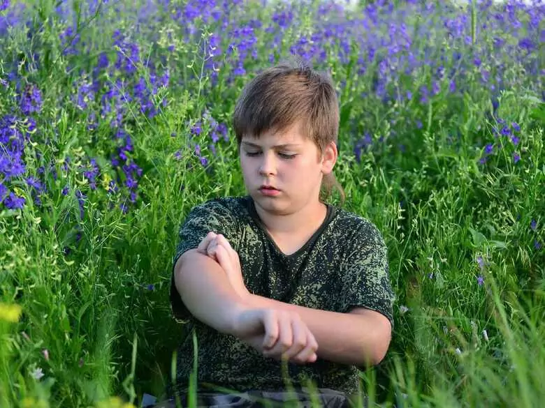 Allergie de contact chez l'enfant : étude des facteurs pouvant la provoquer