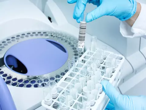 Infertilité - quels tests effectuer ?