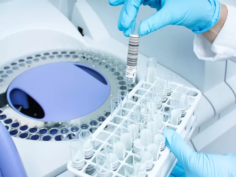 Le miARN-16 peut-il aider à traiter la maladie d'Alzheimer ?