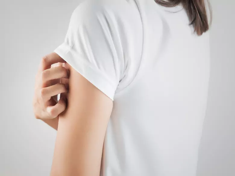 Comment traiter la séborrhée cutanée excessive ?