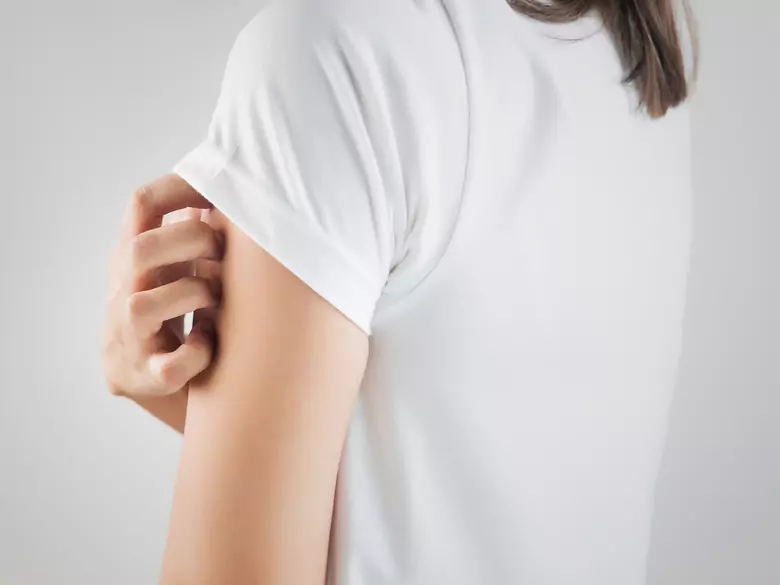 Comment traiter la séborrhée cutanée excessive ?