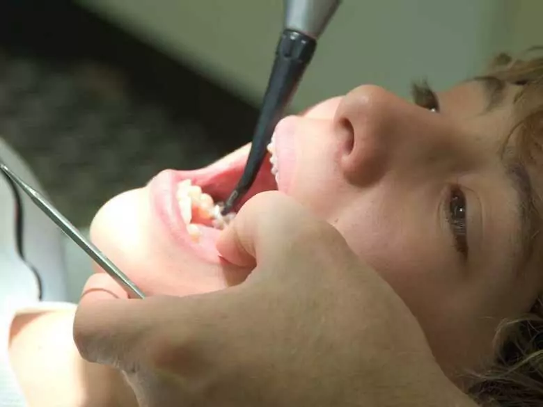 Les maladies bucco-dentaires et le risque de maladies d'autres organes