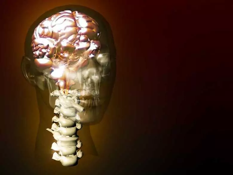 Sclérose en plaques - définition, formes, symptômes