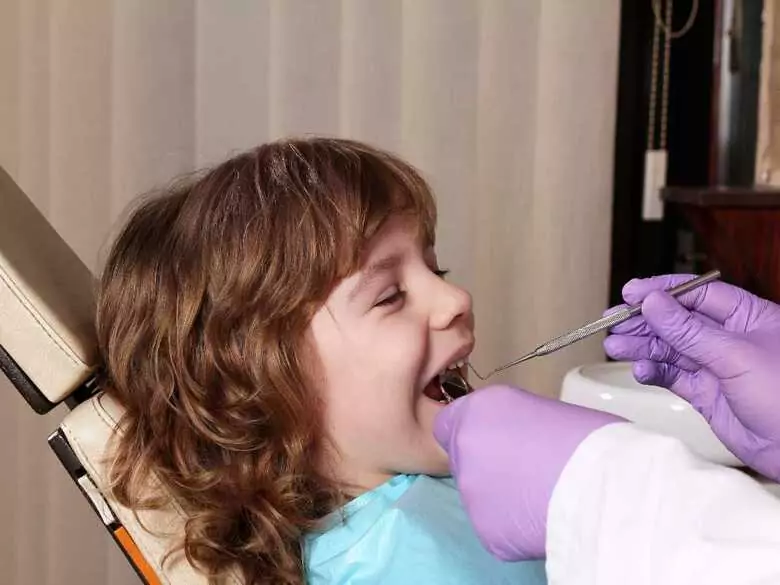 Malocclusion chez l'enfant - causes, symptômes, diagnostic, traitement