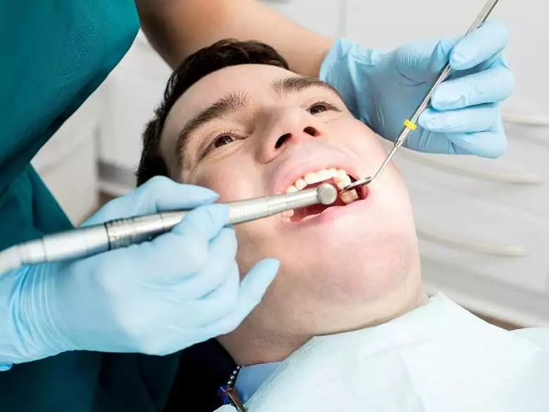 Facettes dentaires - avantages et inconvénients