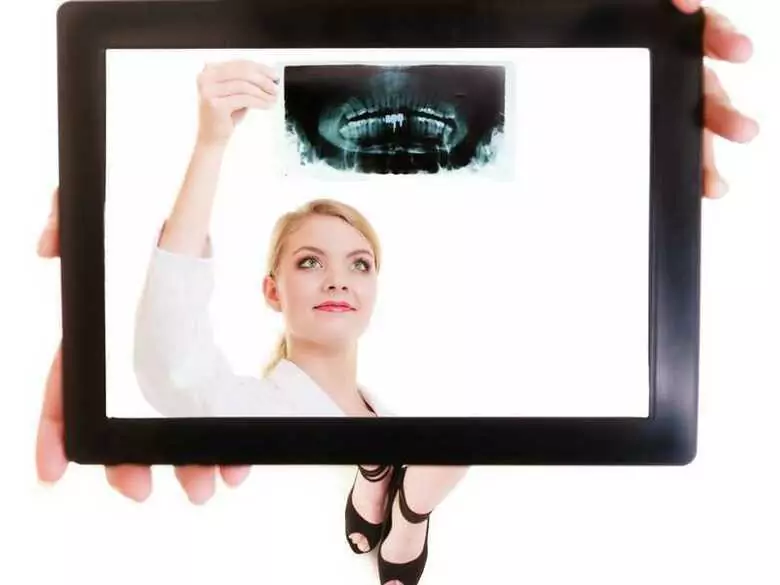 Collet des dents exposé - causes, symptômes, diagnostic, traitement