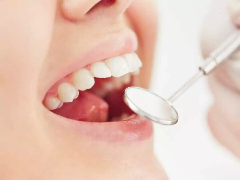 Grincement des dents - causes, symptômes, diagnostic, traitement