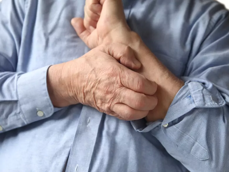 Prurit psychogène : le lien entre dermatologie et psychiatrie