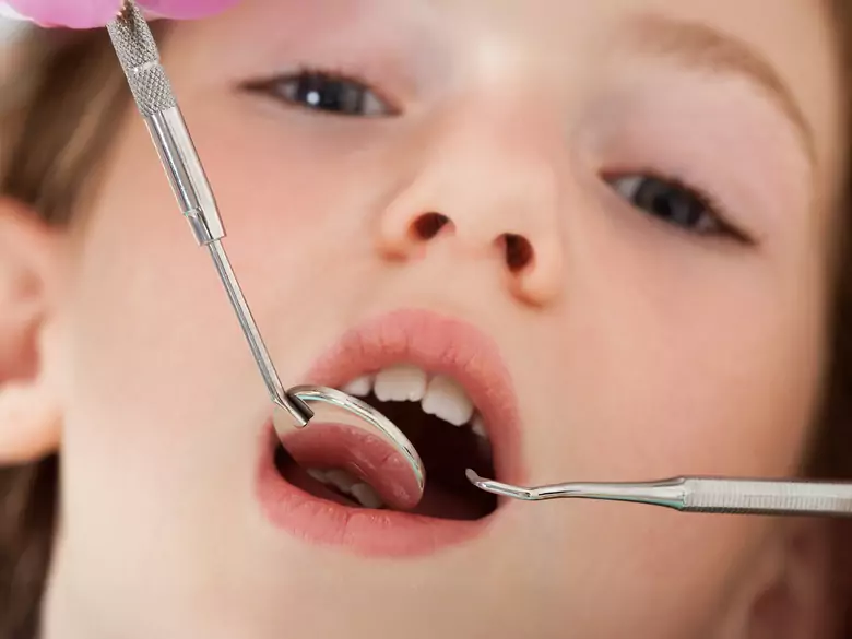 Comment soigner les dents de mon bébé ?