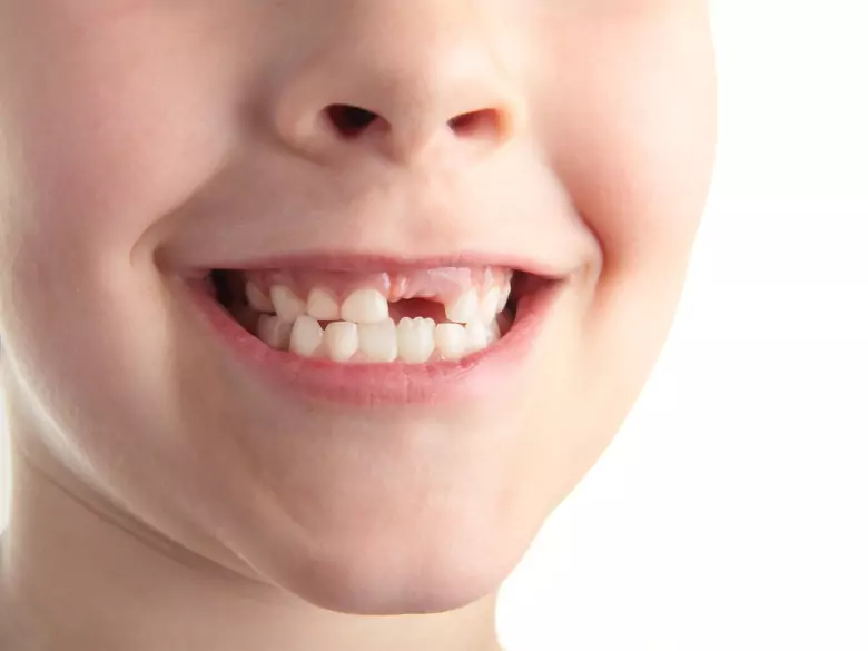 Le grignotage entre les repas expose les enfants au risque de caries et d'obésité