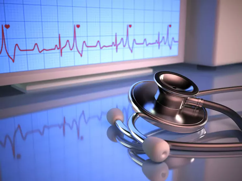 Infarctus du myocarde - causes, symptômes, diagnostic, traitement