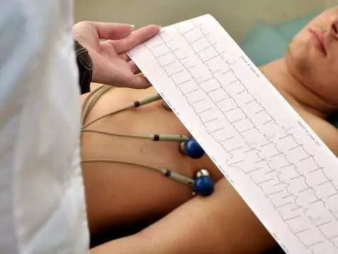 Qu'est-ce qu'un ECG ?