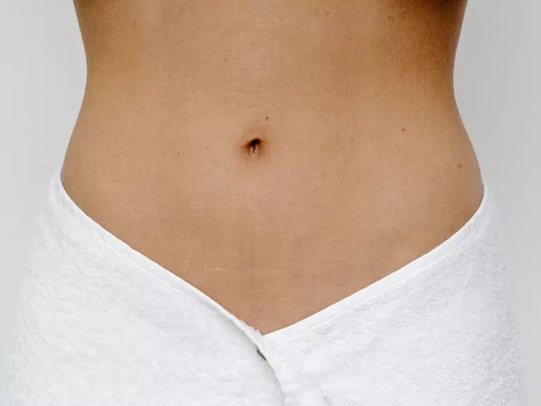 Hypertrophie labiale