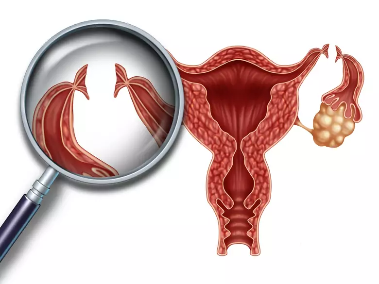 L'utérus et sa relation avec... mémoire