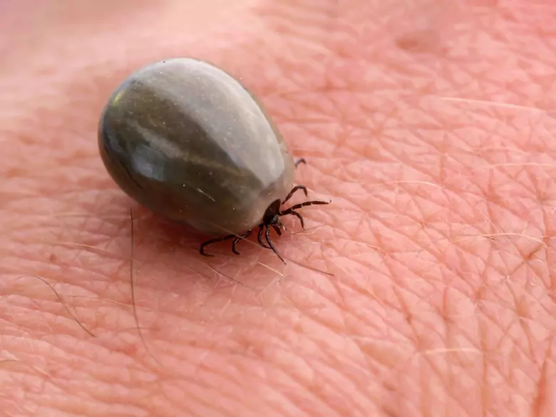 La fièvre pourprée des montagnes Rocheuses - qu'est-ce que c'est ?