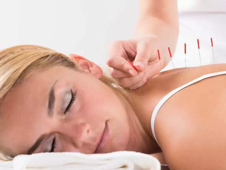 Quels sont les avantages de l'acupuncture et des autres thérapies alternatives ?
