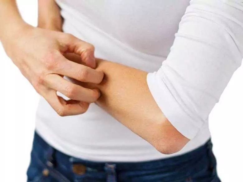 Peau des mains craquelée après l'utilisation de liquide vaisselle - s'agit-il d'une allergie ?