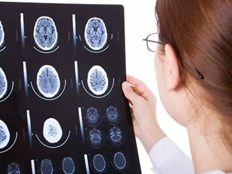 Le neurone comme transmetteur d'informations importantes