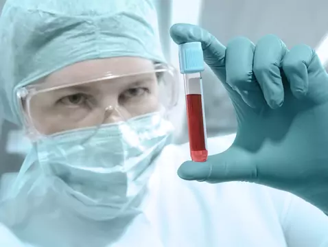 Le lifting vampirique - une panacée pour la vieillesse ?