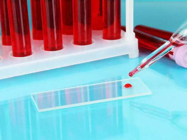 Comment prévenir la formation de caillots sanguins ?