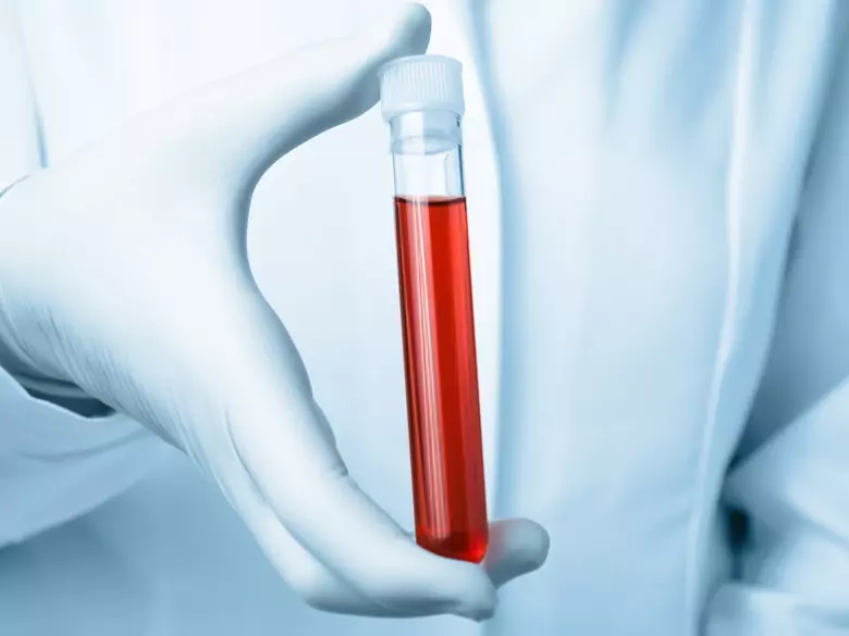Conflit sérologique - qu'est-ce que c'est, quand peut-il se produire ?