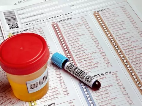 Endocrinologie de la période ménopausique