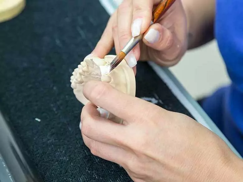 Les prothèses dentaires squelettiques - leurs avantages et leurs inconvénients