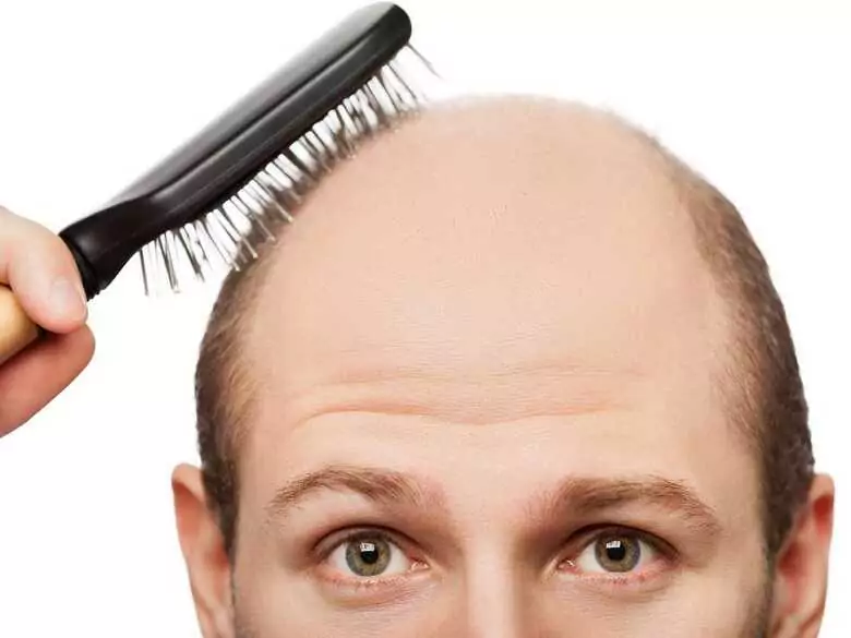 Les stéroïdes ? Au lieu de sculpter, l'infertilité et la calvitie