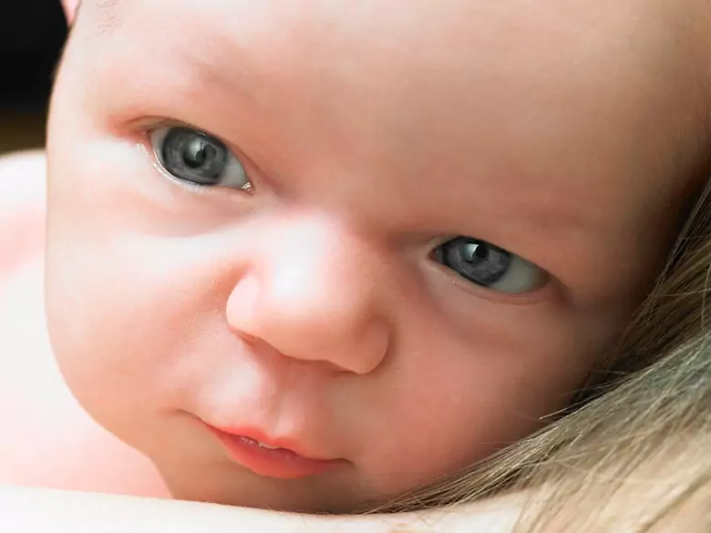 Paralysie cérébrale