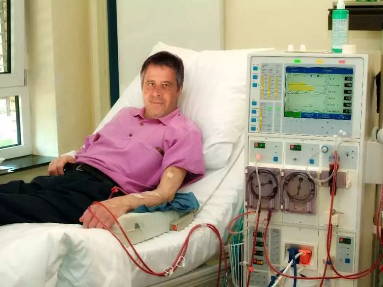 Des médecins tchèques ont contribué à expliquer la cause d'une maladie rénale rare