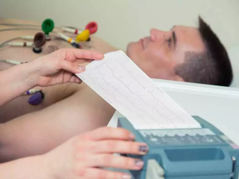 Troubles du rythme cardiaque