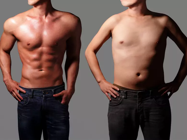 Dysmorphophobie et chirurgie plastique