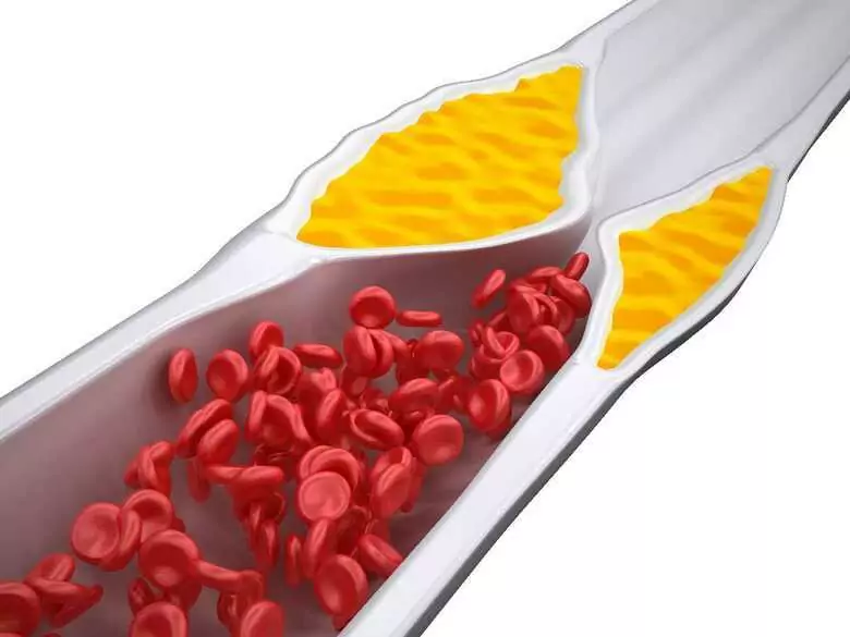 Est-il possible d'avoir "trop" de cholestérol HDL ?