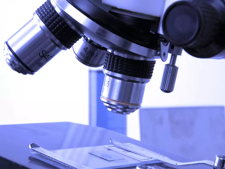 Symptômes et évolution de la toxocarose