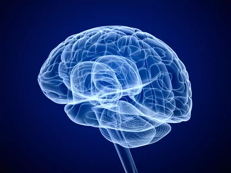 Accident vasculaire cérébral (AVC) - symptômes, comment le reconnaître