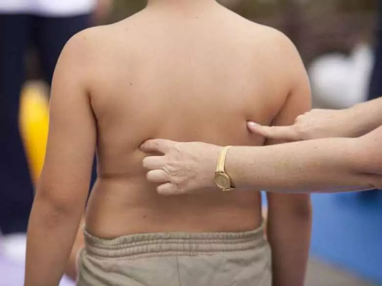 L'athérosclérose et l'infarctus du myocarde chez l'enfant, est-ce possible ?