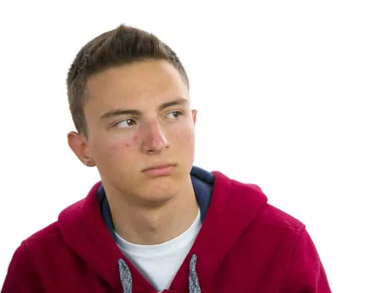 Les afterburbs - comment reconnaître si un enfant en a consommé ?