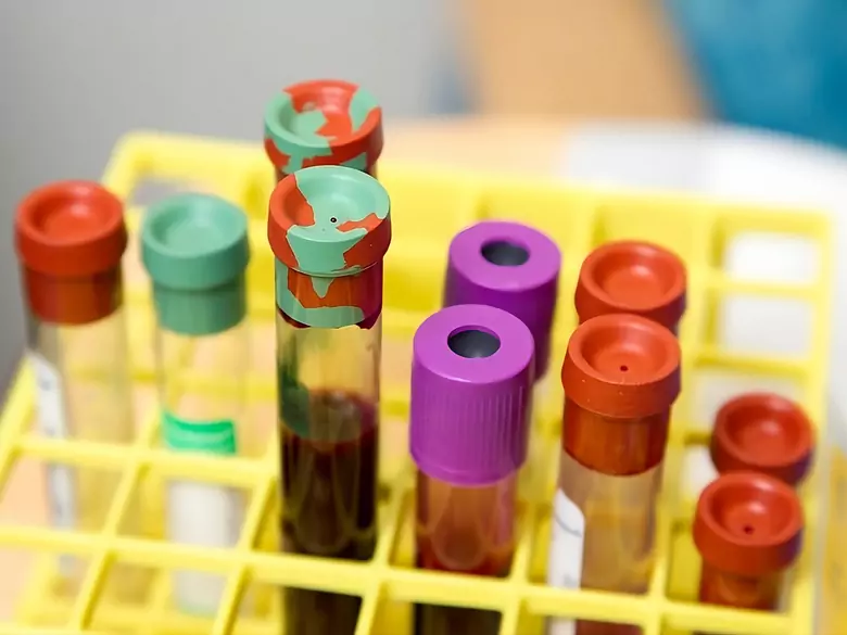 Oncopackage - pourquoi les tests de micronutriments sont-ils si importants pour la détection du cancer ?