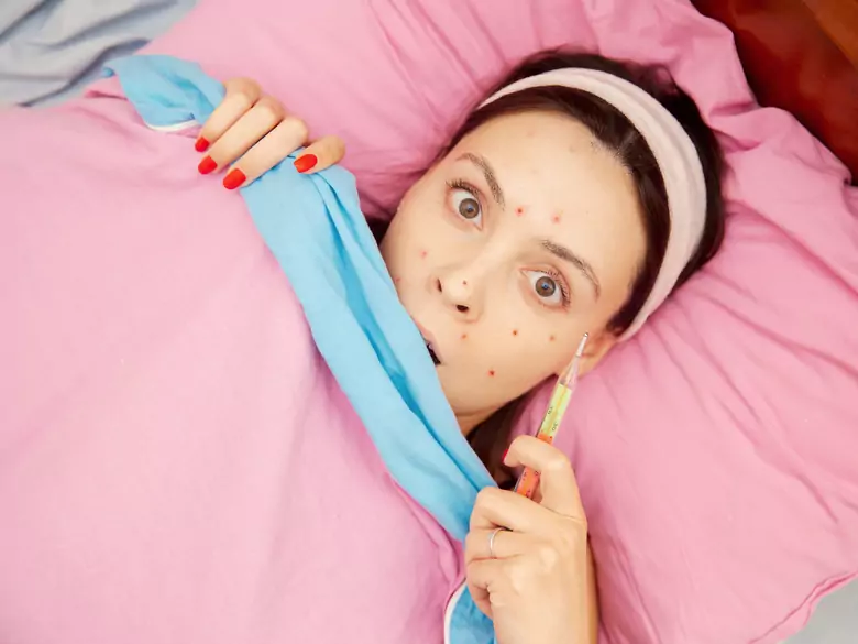 Symptômes et conséquences de la varicelle à l'âge adulte