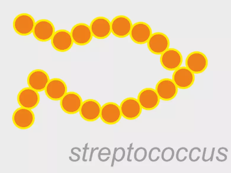 Test SAO - titre élevé