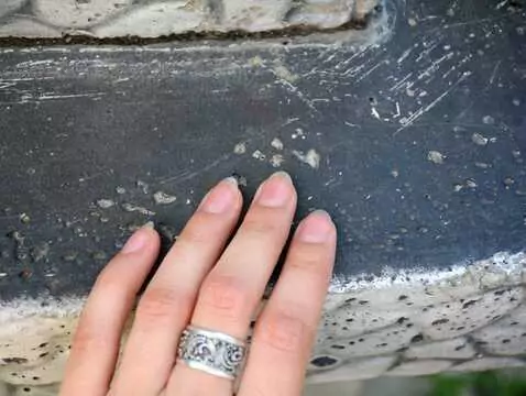 Champignons des ongles - causes, symptômes, diagnostic, traitement