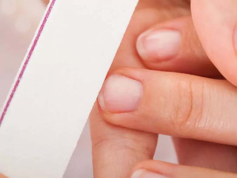 Changements de forme des ongles - causes, symptômes, diagnostic, traitement