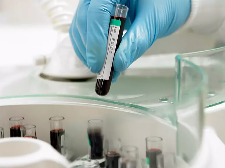 Anémie pendant la grossesse - causes, symptômes, diagnostic, traitement