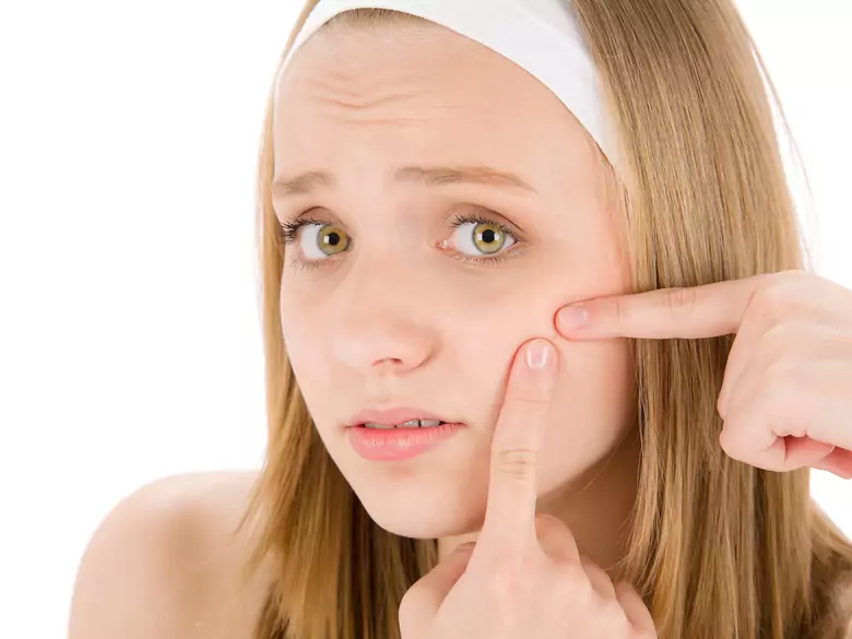 Pathogenèse et traitement de l'acné vulgaire