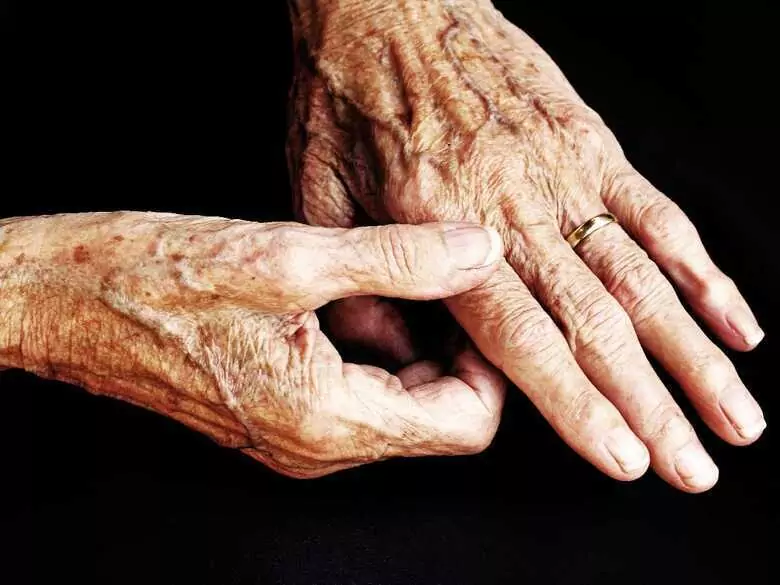 Stimulation du nerf vague contre traitement de la PR