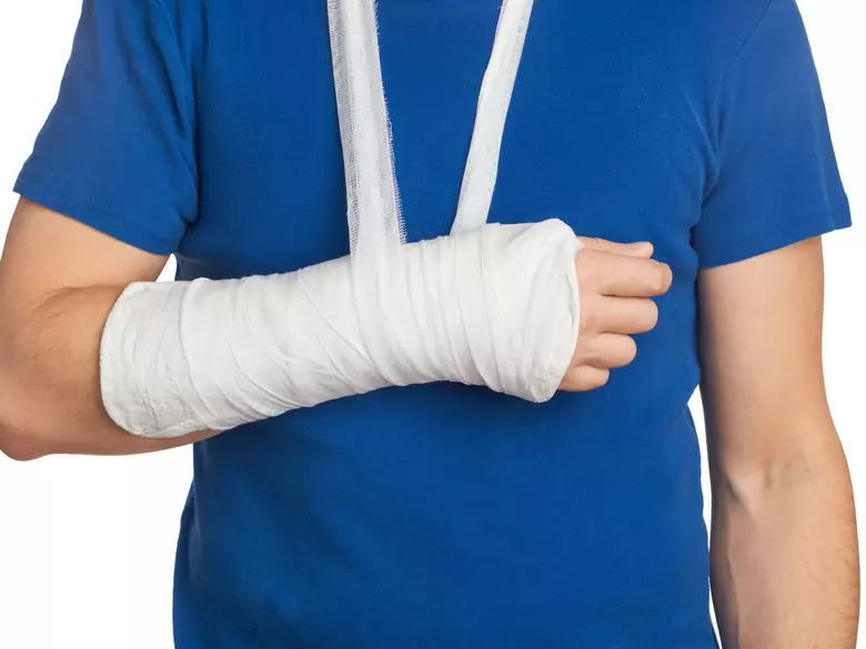 Fracture de la phalange ou fracture de la phalange - premiers secours