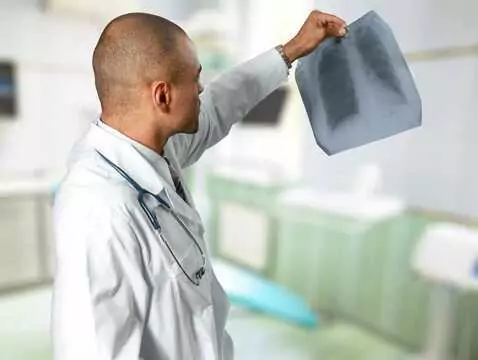 Qu'est-ce qu'une alimentation saine pour les personnes souffrant de problèmes pulmonaires ?